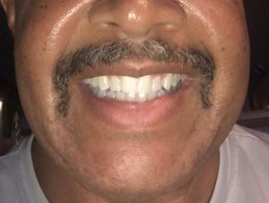 Darren Davies - Daddy Vancouver, Canada